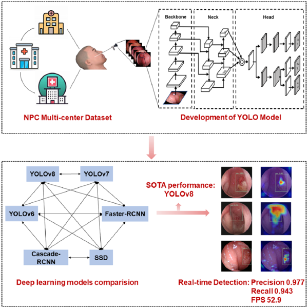 我院李健教授团队一项鼻咽癌人工智能识别研究成果在《iScience》上发表
